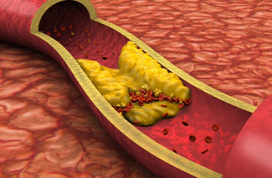 OMEGA-3 Y COLESTEROL