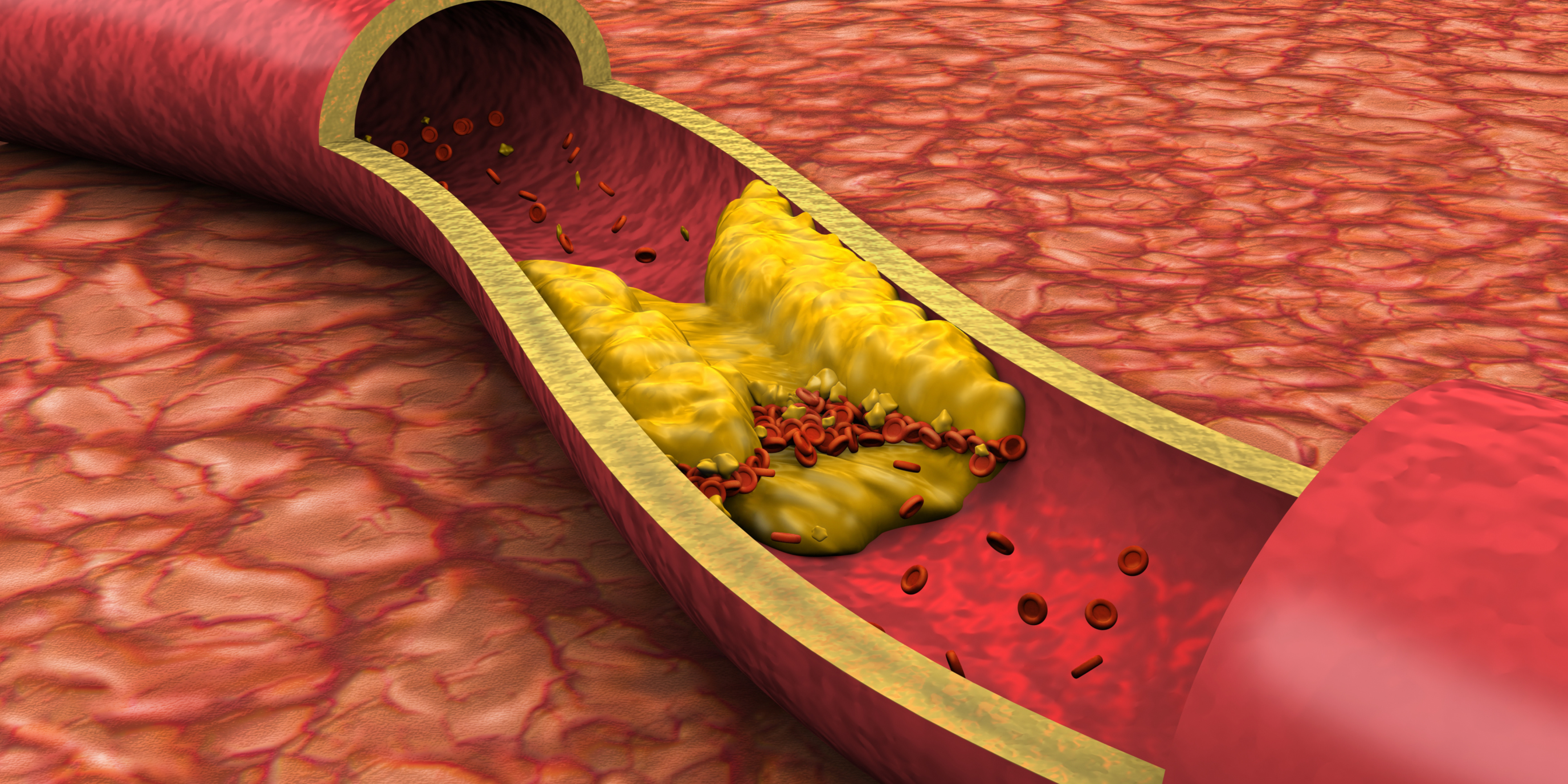 OMEGA-3 Y COLESTEROL